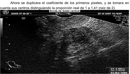 Fig 5.11  Operador de Sobel vertical.