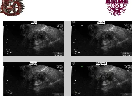 Fig. 5.15  Descomposición de la imagen en RGB.