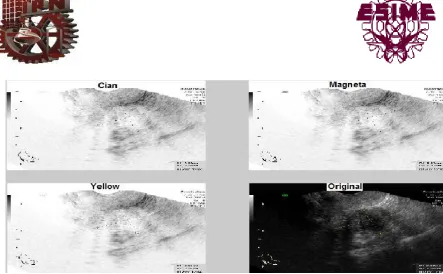 Fig. 5.16  Descomposición de la imagen en CMY.