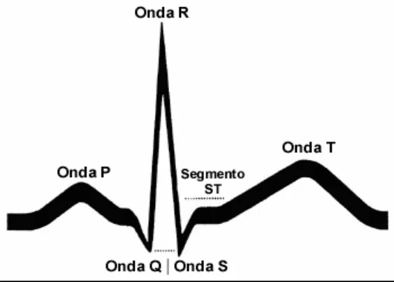 fig. 3 Imagen electrocardiográfica normal 