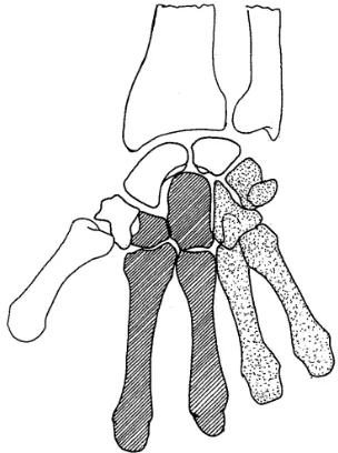 Figura 2.10.- Transmisión de la carga a los huesos cúbito  y radio a través de los pilares de la mano(Marreno and Cunillera, 1998) 