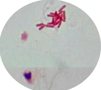 Fig. N°1. Tinción Gram en muestra seminal y presencia de bacterias Gram negativas. 