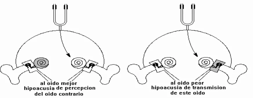 Fig. 2.3 Prueba Weber – Bernal Zafra, S. - UCA –2.000  