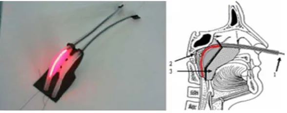 Figura 1.4 Fuentee de irradiaciión nasofarínngea 