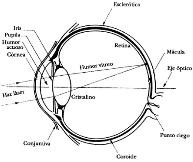 Figura 3.12 Esquema operación ocular con laser. 