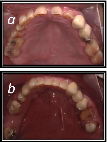 Figura  3.  Examen  clínico  intraoral.  (a)  fotografía  oclusal  superior.  (b)  fotografía oclusal inferior