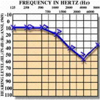 FIG 3.2.1.1 GRÁFICA DE PÉRDIDA DE AUDICIÓN