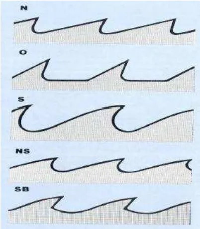 Fig. 2.6 Tipos de diente de sierra y formas 