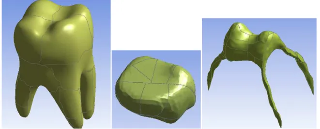 Figura 5.10  Modelos de los componentes dentales en formato IGES.  5.4.2 GENERACIÓN Y ANÁLISIS DEL MODELO POR MEDIO DEL MEF 