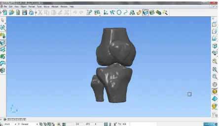 Figura V.4.- Obtención del modelo sólido de la articulación de rodilla en el programa POWER SHAPE 2010  