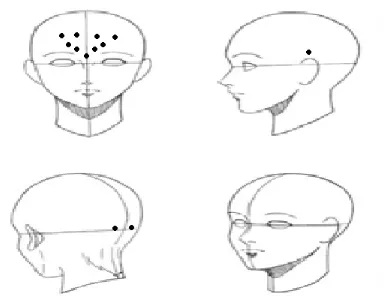 Figura 1. Puntos de aplicación en cefalea vascular. 