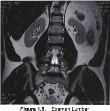 Figura 1.5.  Examen Lumbar 