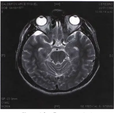 Figura  1.6.  Examen cerebral  1.1.5.  Medicina Nuclear 