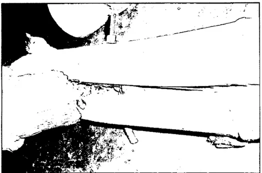 Figura N. 4.13 Doblez interior de los ganchos  y  del perno, recomendación  alargar la longitud de los ganchos