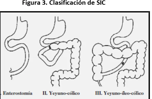 Figura 3. Clasificación de SIC 