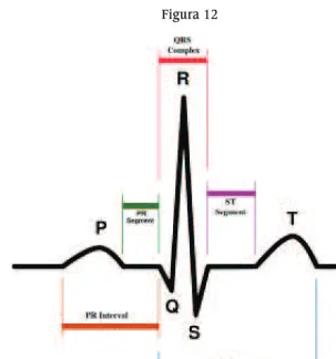 Figura 12