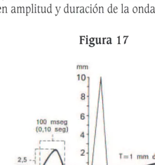 Figura 17