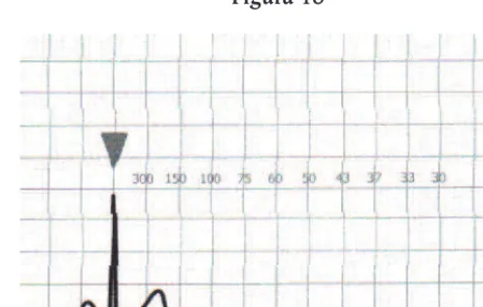 Figura 18