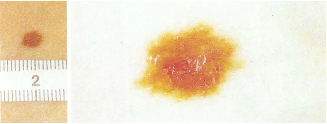 Figura 4 