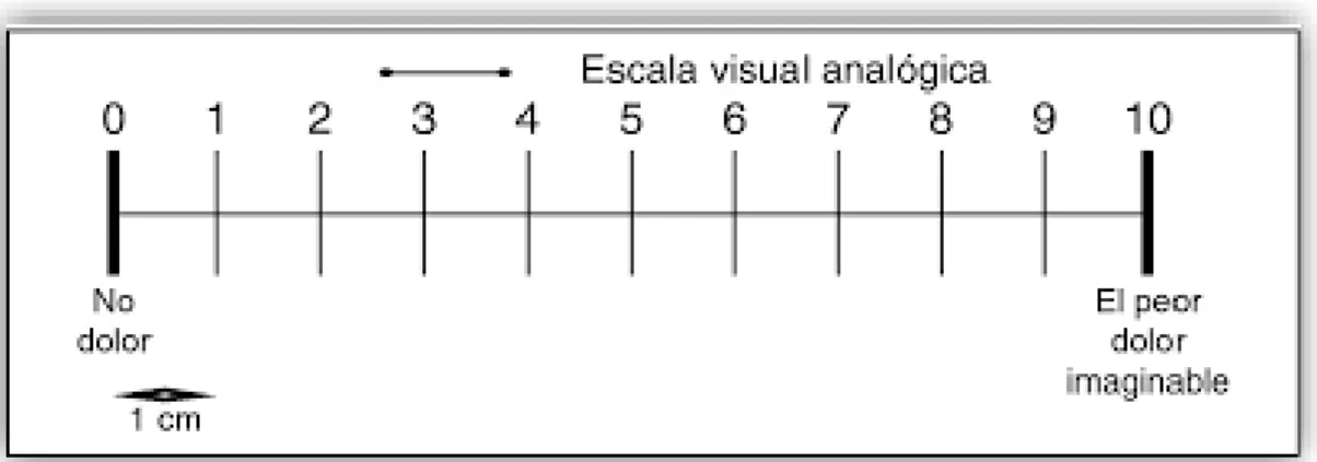 Figura 4. Escala Visual Analógica  Nota: Tomado de (Breivik et al., 2008)