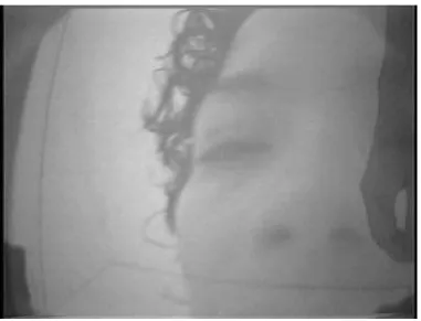 Fig. 7. TKO  