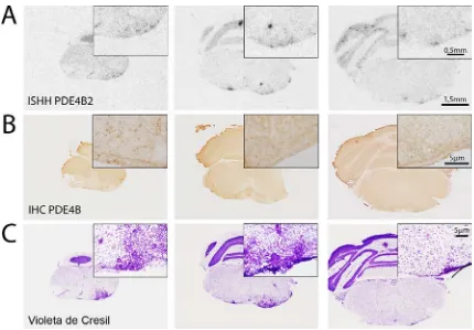 Figura 14. Comparació de diverses seccions coronals de cervell de ratolí EAE 21 dies post-immunització en ((A) hibridació in situ radioactiva (ISHH) de l’ARNm de PDE4B2, (B) immunohistoquímica (IHC) de PDE4B i C) tinció de Violeta de Cresil