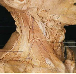 Figura 1: Triángulos anatómicos del cuello: el cuello se divide en un triángulo anterior y uno posterior por el músculo esternocleidomastoideo (modificado por Le Beuf HJ y Quinn FB a partir de Jurkovich GJ: The neck, en: Early care of the injured patient