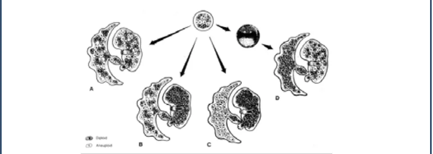 Fig.1.5 Tipus de mosaicisme: (A) Generalitzat, (B) Confinat a placenta amb les dues línies cel·lulars representades a placenta, 