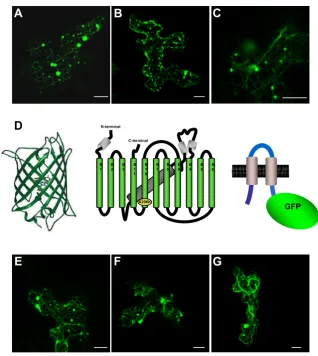 Figura R.1: Estructura i localització subcel·lular de les quimeres 1S:GFP i 1S:GFPmono
