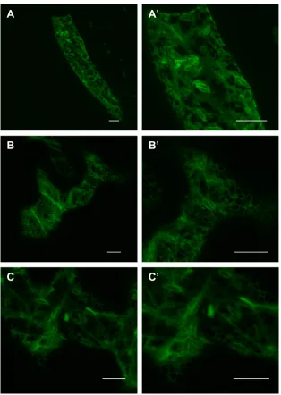 Figura R.8: Localització subcel·lular de la quimera 1S:GFP a cèl·lules epidèrmiques de la zona proximal de cotiledó de plantes 