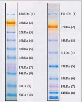 Figura 4. Gel teñido con Gel CodeR Blue Stain Reagent. Para mostrar las condiciones de la electroforesis