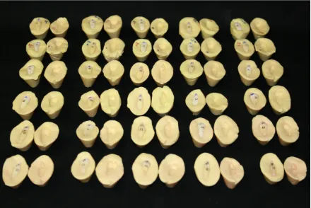 Figura 5.3. Muestra preparada en bloques de silicona  (caras proximales A y B para cada diente) para su posterior evaluación al Microscopio Confocal