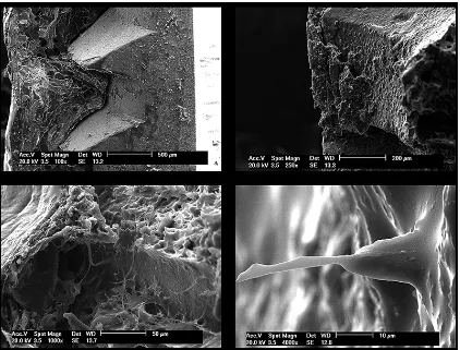 Figura 3. Imágenes realizadas con microscopia electrónica de barrido (MEV) de la 