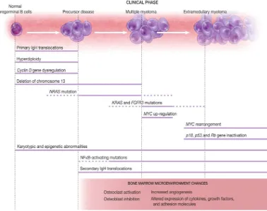 Figura 1. Eventos biológicos relacionados con la progresión a Mieloma múltiple. La transición biológica de las células plasmáticas normales a MGUS, SMM y MM compuestos de muchos eventos oncogénicos superpuestos