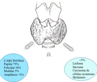 Figura 2. Distribución de porcentajes de la patología tiroidea maligna. 