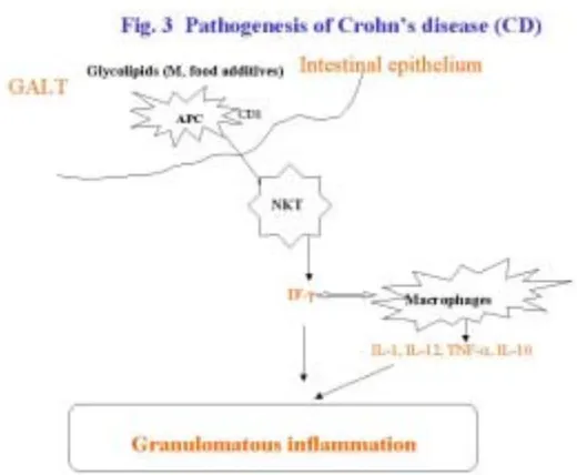 Fig. 4  Histological aspects of Crohn’s disease (CD) 