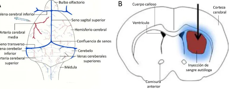 Figura 4: Representación de dos ejemplos de modelos experimentales in-vivo de isquemia y hemorragia cerebral