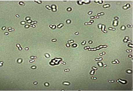 Fig. 3. Microfotografía electrónica de las BA (A. pasteurianus) 