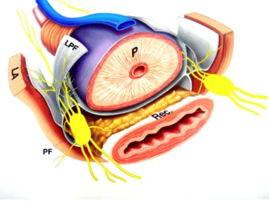 Figura 1: (P) próstata,  (Rec) recto, (PF) fascia pélvica, (LPF)  fascia pélvica izquierda, (LA) elevador del ano