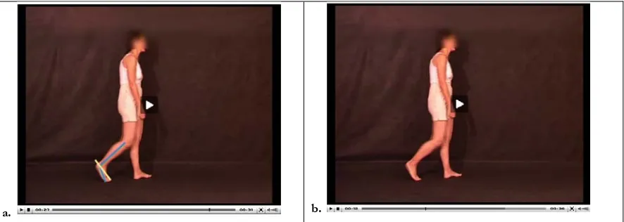 Fig. 4. Imagen de un caso real en formato vídeo con retroalimentación visual (a) y sin ella (b)