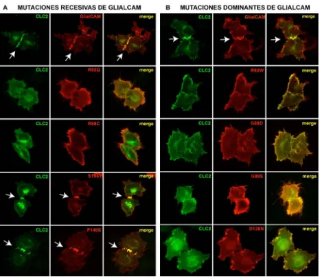 Figura 96: ClC-2 sigue la localización de las variantes de GlialCAM en células HeLa. Células HeLa fueron transfectadas con ClC-2 y con GlialCAM salvaje o con los plásmidos correspondientes que portan las mutaciones indicadas