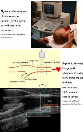 Figure 4. Measurement 
