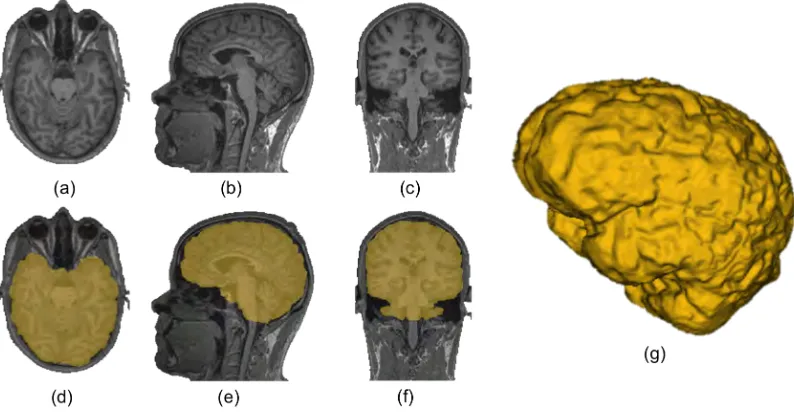 Figure 2.2: Head MRI representation. The three orientations are ilustrated: (a) axial, (b)sagital, and (c) coronal