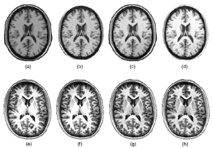 Figure 2.3: MRI intensity corrections. First row represents a BrainWeb T1w simulatedimage: (a) original image, (b) 9% of noise image, (c) 40% of bias ﬁeld image, and (d)image with both eﬀects applied
