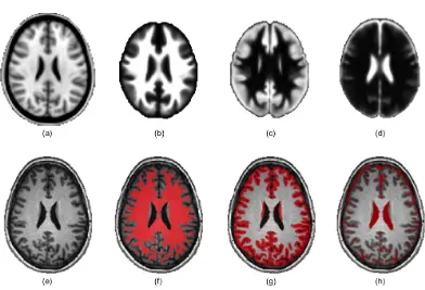 Figure 2.5: Brain tissue segmentations: (a) Average atlas and its prior tissue maps ((b)WM, (c) GM and (d) CSF) used in SPM12 for tissue segmentation.The second rowrepresents (e) the original T1w 3T MRI data and the tissue mask results in red: (f) WM,(g) GM and (h) CSF.