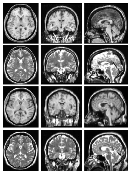 Fig. 1 – Brain MRI examples from a 1.5 T GE scanner (ﬁrst and second row) and a 3 T scanner (third and fourth row) of T1wimages (ﬁrst and third rows) and T2w images (second and fourth rows)