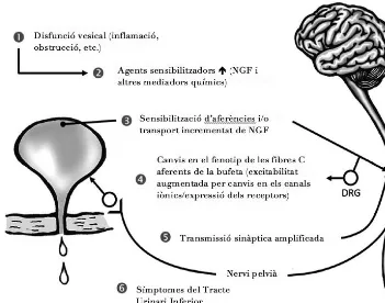 Figura 8. Mecanismes hipotètics que indueixen disfunció del tracte urinari inferior. Yoshimura et al, Neurourol Urodyn 2014.