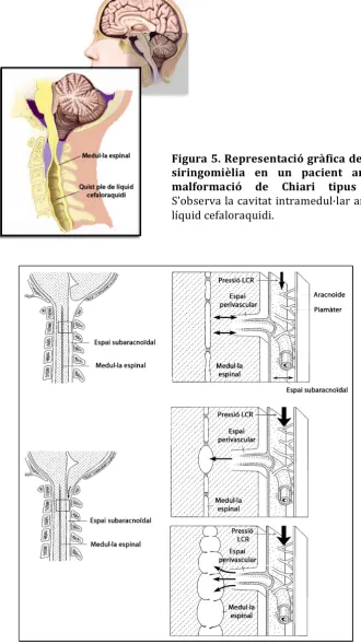 Figura   5.   Representació   gràfica   de   la   