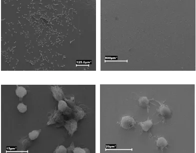 Figs 15 y 16 Imágenes de microscopía láser confocal de capa de colágeno tipo Ia con células SAOS - 2 