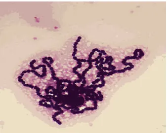 Figura 2: Streptococcus agalactiae en microscopía óptica. 